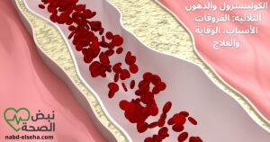 الكوليسترول والدهون الثلاثية: الفروقات، الأسباب، الوقاية والعلاج